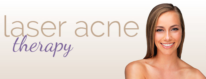 laser acne therapy