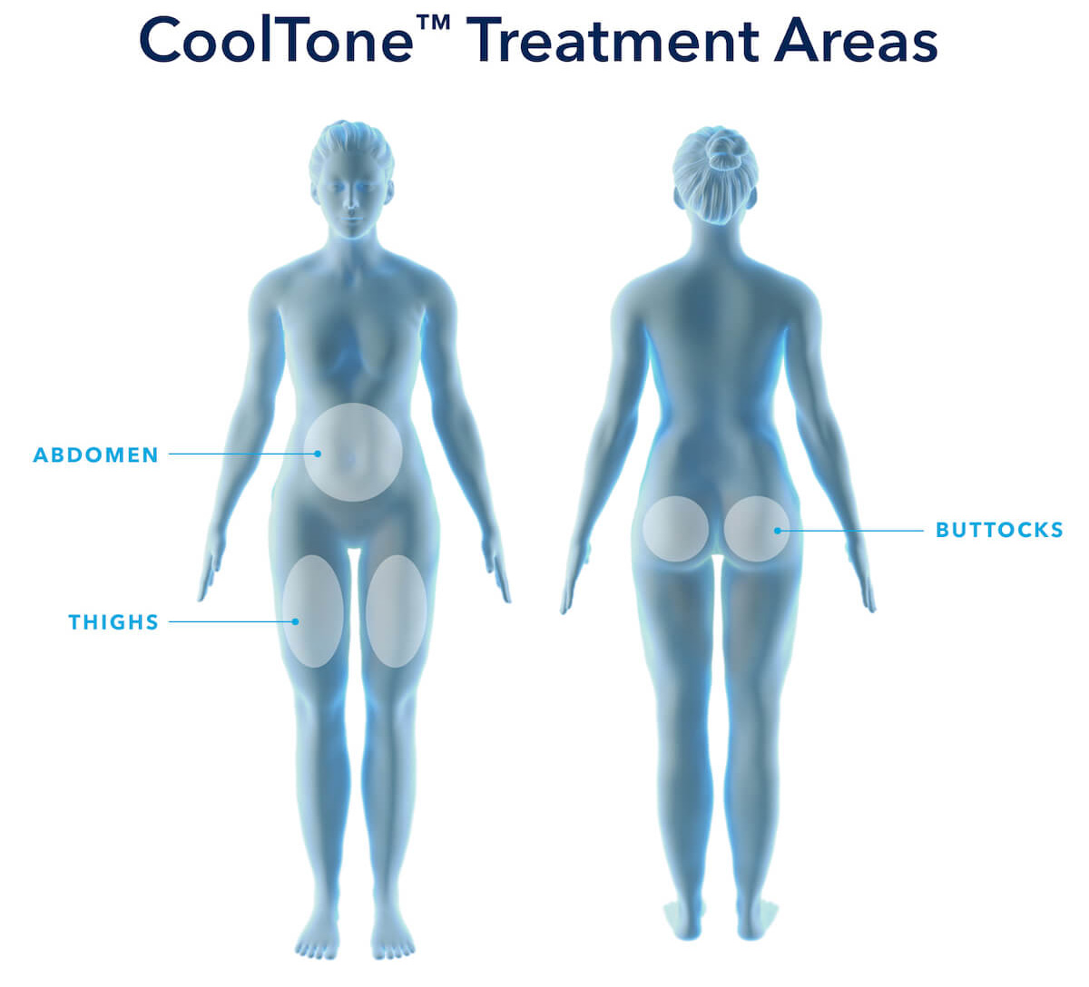 CoolTone treatment areas